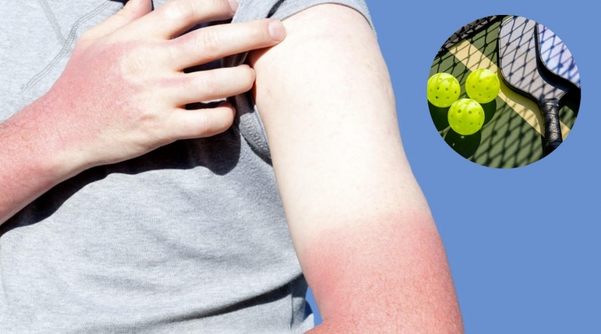 9 Không dùng kem chống nắng làm tia UV phá hủy collagen, gây rối loạn sắc tố