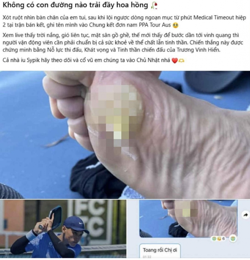 Ảnh đôi chân phồng rộp gây xót xa